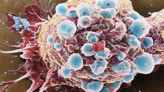 "Starving" cancer cells a key to new tumor treatments: Aussie researchers 
